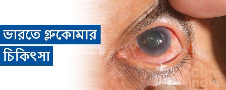 গ্লুকোমা চিকিৎসা